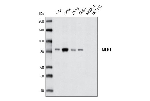 Image 3: Mismatch DNA Repair (MMR) Antibody Sampler Kit