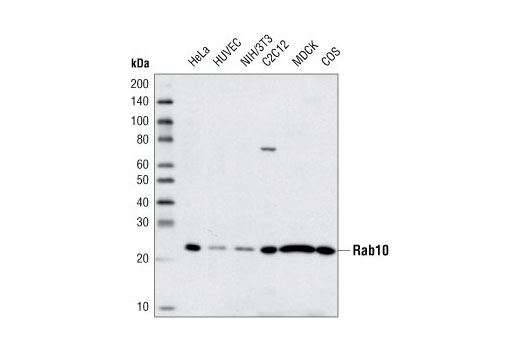 Western Blotting Image 1: Rab10 Antibody