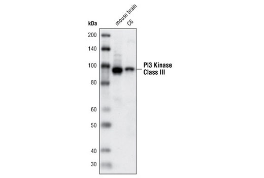  Image 4: Beclin-1 Complex Antibody Sampler Kit