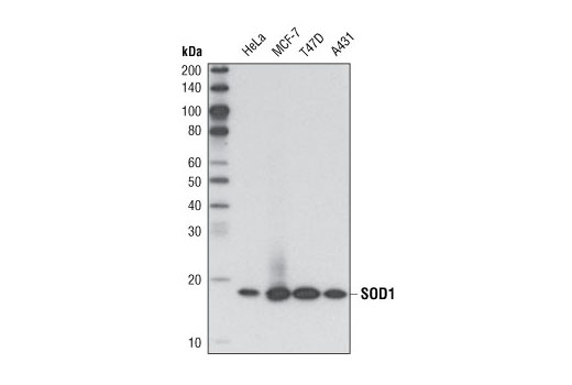  Image 6: Mitochondrial Marker Antibody Sampler Kit