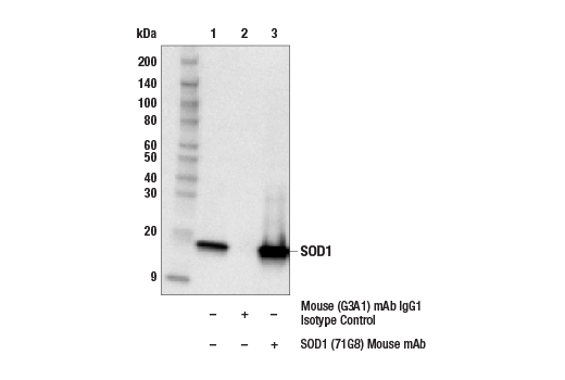  Image 1: Mitochondrial Marker Antibody Sampler Kit