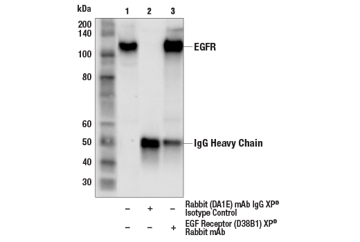  Image 10: Phospho-EGF Receptor Antibody Sampler Kit