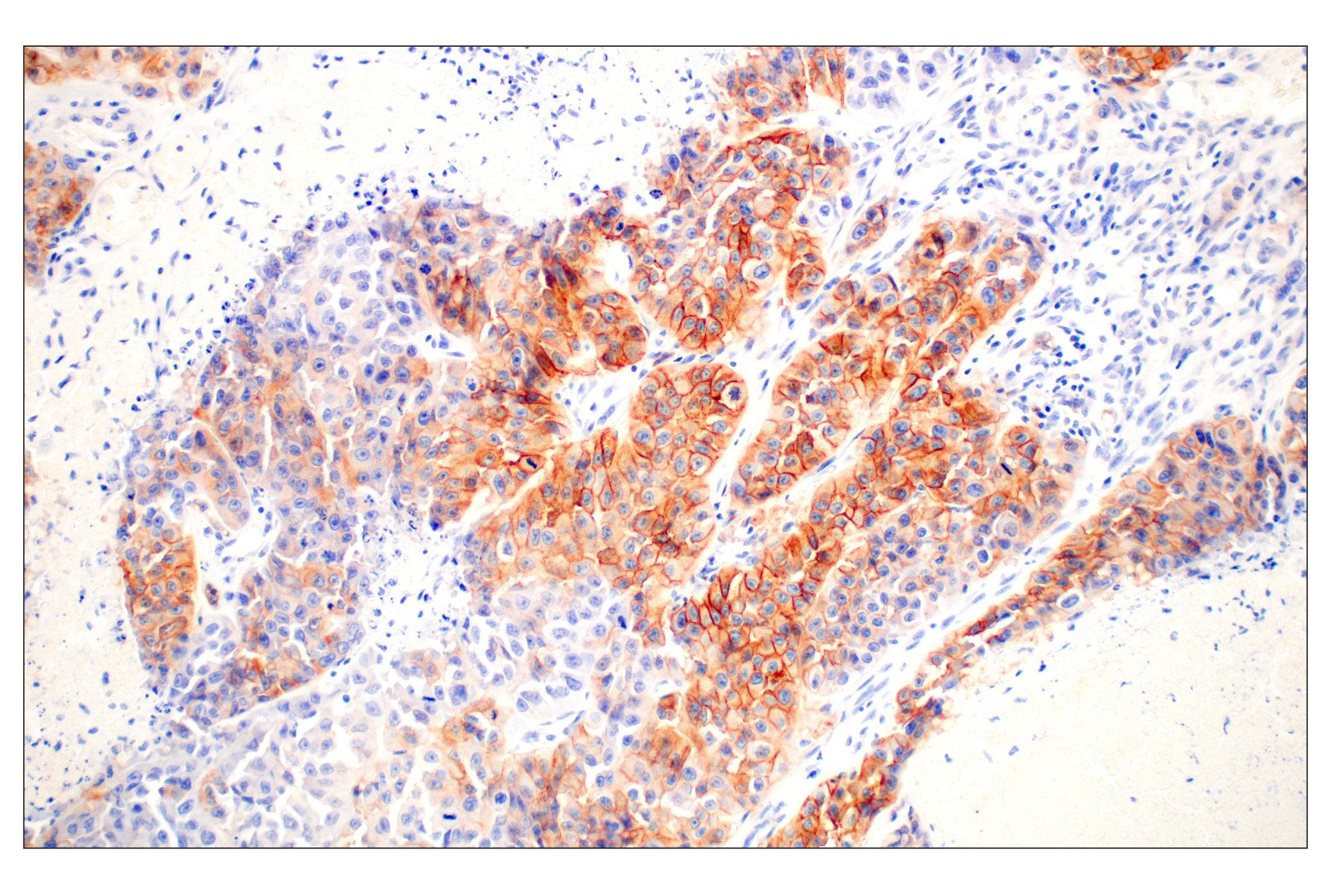  Image 9: PhosphoPlus® EGFR (Tyr1068) Antibody Duet