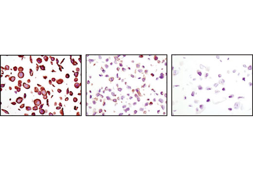  Image 9: PhosphoPlus® EGFR (Tyr1068) Antibody Duet