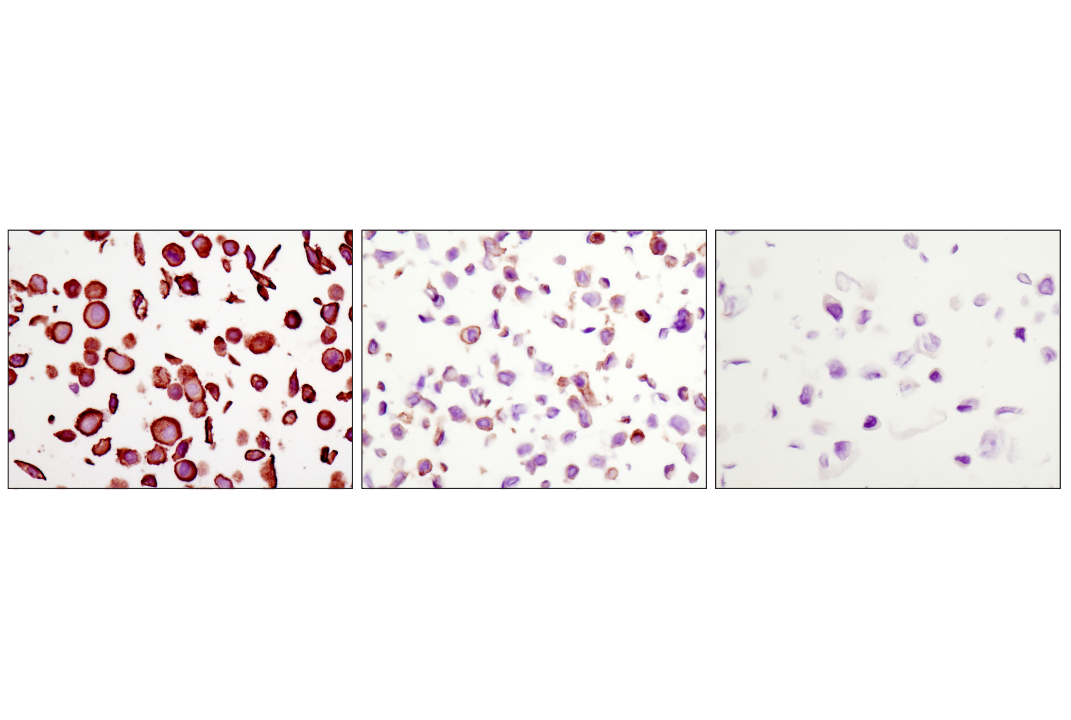  Image 15: PhosphoPlus® EGFR (Tyr1068) Antibody Duet