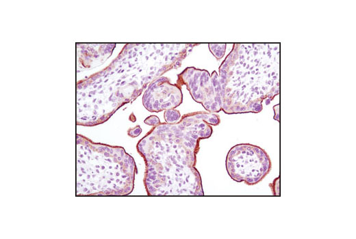  Image 12: PhosphoPlus® EGFR (Tyr1068) Antibody Duet