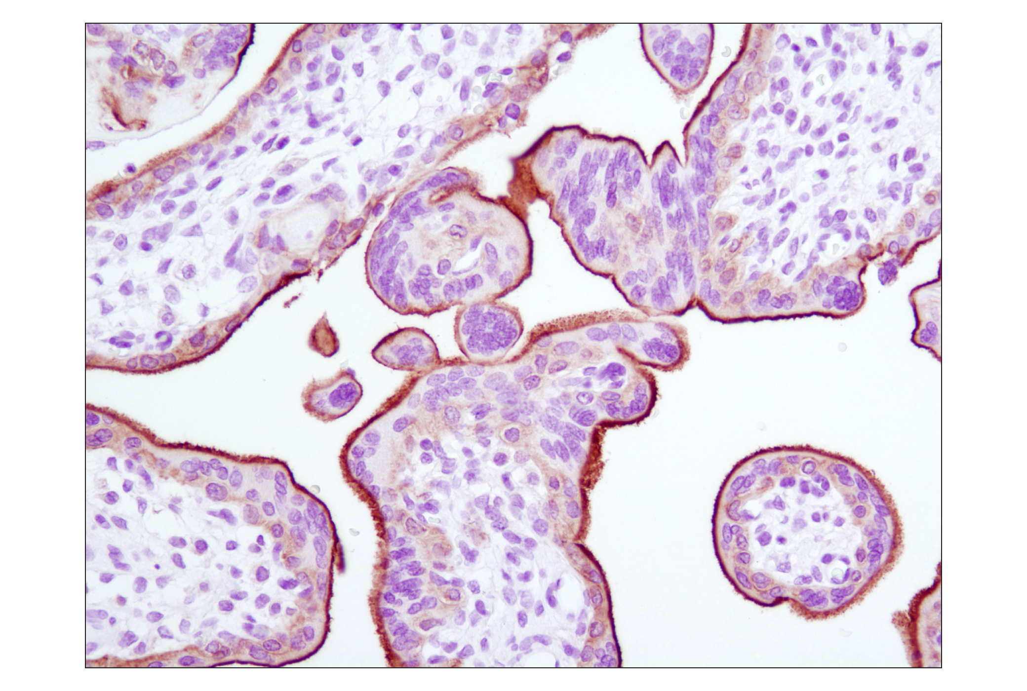  Image 14: PhosphoPlus® EGFR (Tyr1068) Antibody Duet