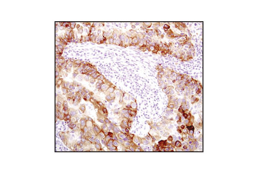  Image 13: PhosphoPlus® EGFR (Tyr1068) Antibody Duet