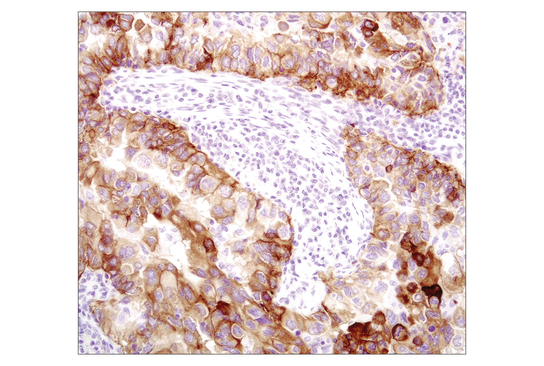  Image 13: PhosphoPlus® EGFR (Tyr1068) Antibody Duet
