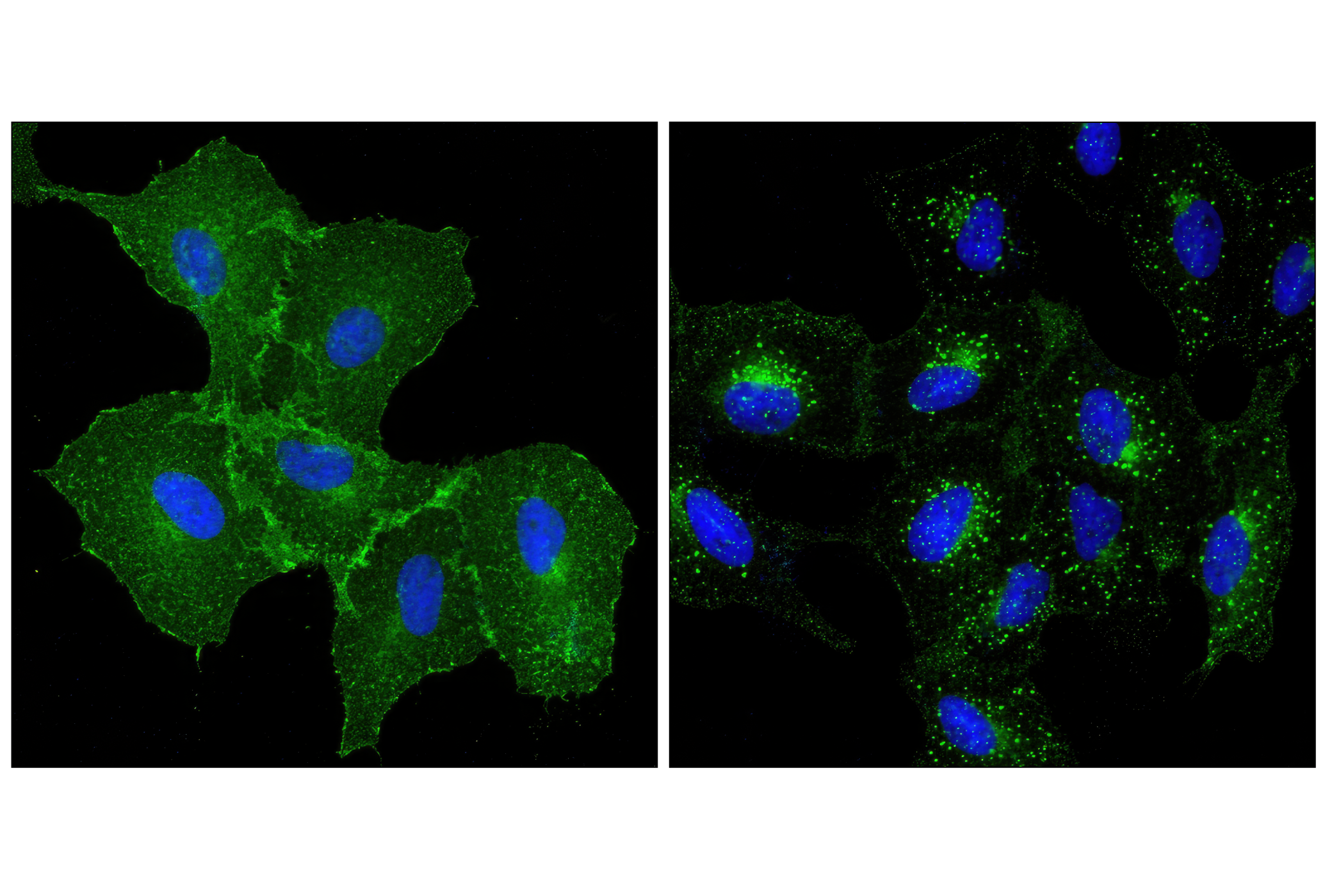 Immunofluorescence Image 2: EGF Receptor (D38B1) XP® Rabbit mAb