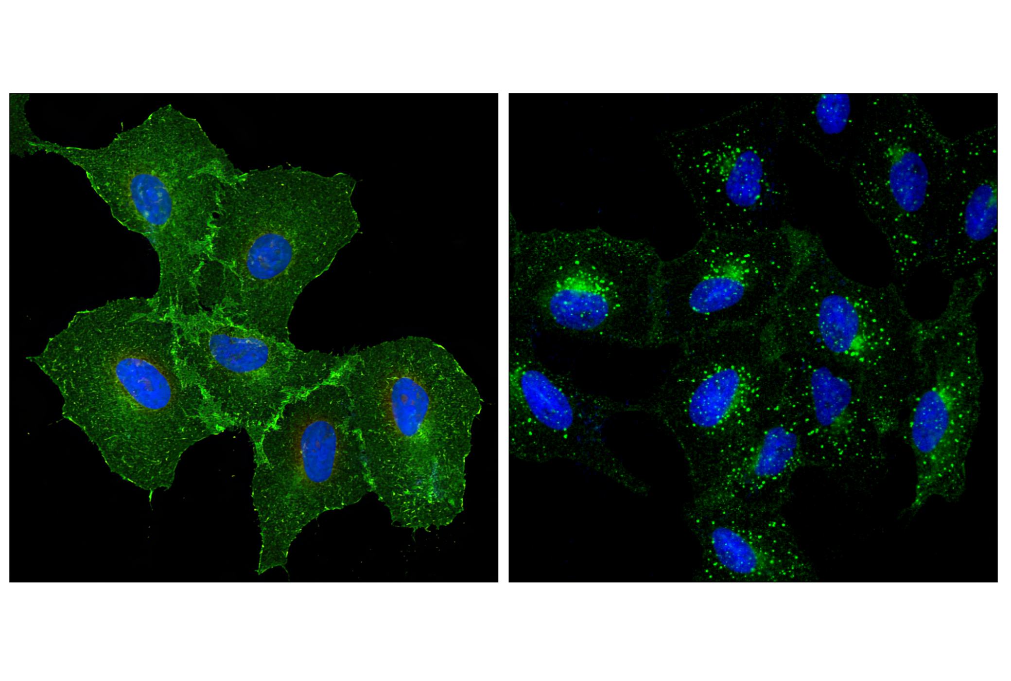Immunofluorescence Image 1: EGF Receptor (D38B1) XP® Rabbit mAb