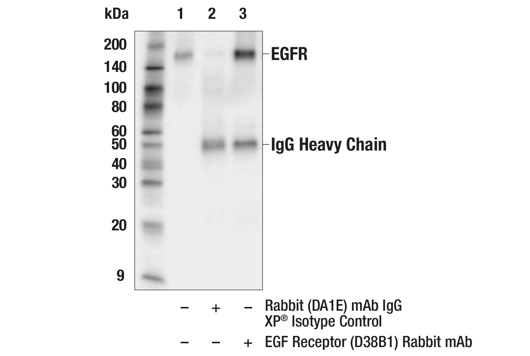 Immunoprecipitation Image 1: EGF Receptor (D38B1) XP® Rabbit mAb