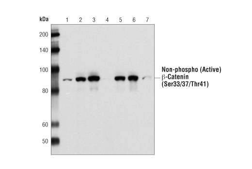 Western Blotting Image 1: Non-phospho (Active) β-Catenin (Ser33/37/Thr41) Antibody