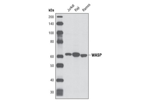 Western Blotting Image 1: WASP (D9C8) Rabbit mAb