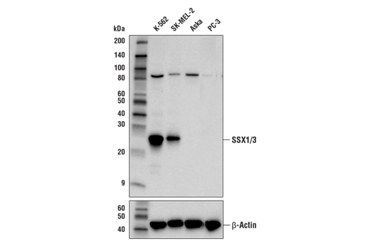 Western Blotting Image 1: SSX1/3 (E9P5M) Rabbit mAb (Amino-terminal Antigen)
