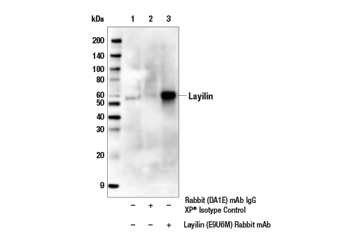 Immunoprecipitation Image 1: Layilin (E9U6M) Rabbit mAb