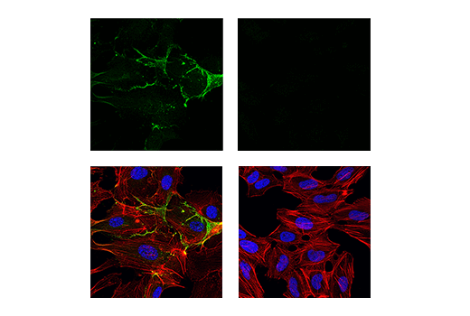 Immunofluorescence Image 1: CD31 (PECAM-1) (89C2) Mouse mAb (Alexa Fluor® 488 Conjugate)