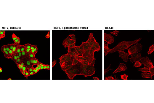 Immunofluorescence Image 1: Phospho-Rb (Ser807/811) (D20B12) XP® Rabbit mAb (Alexa Fluor® 488 Conjugate)