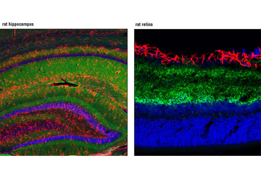 Immunofluorescence Image 1: GAP43 (D9C8) Rabbit mAb (BSA and Azide Free)