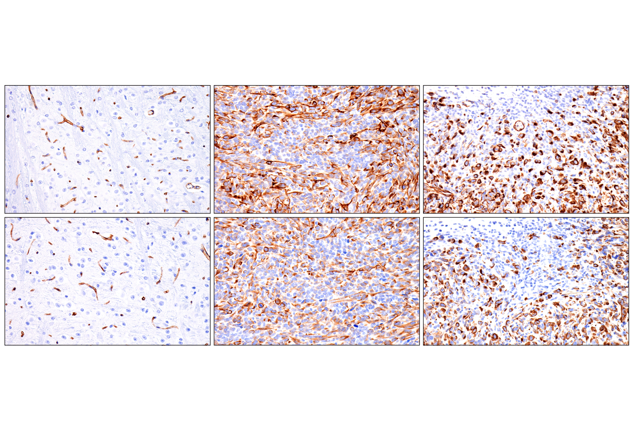 Immunohistochemistry Image 12: Nestin (E5C7I) Rabbit mAb (BSA and Azide Free)