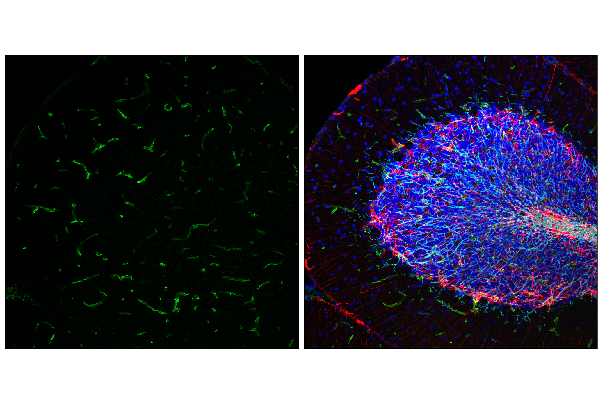 Immunofluorescence Image 2: Nestin (E5C7I) Rabbit mAb (BSA and Azide Free)