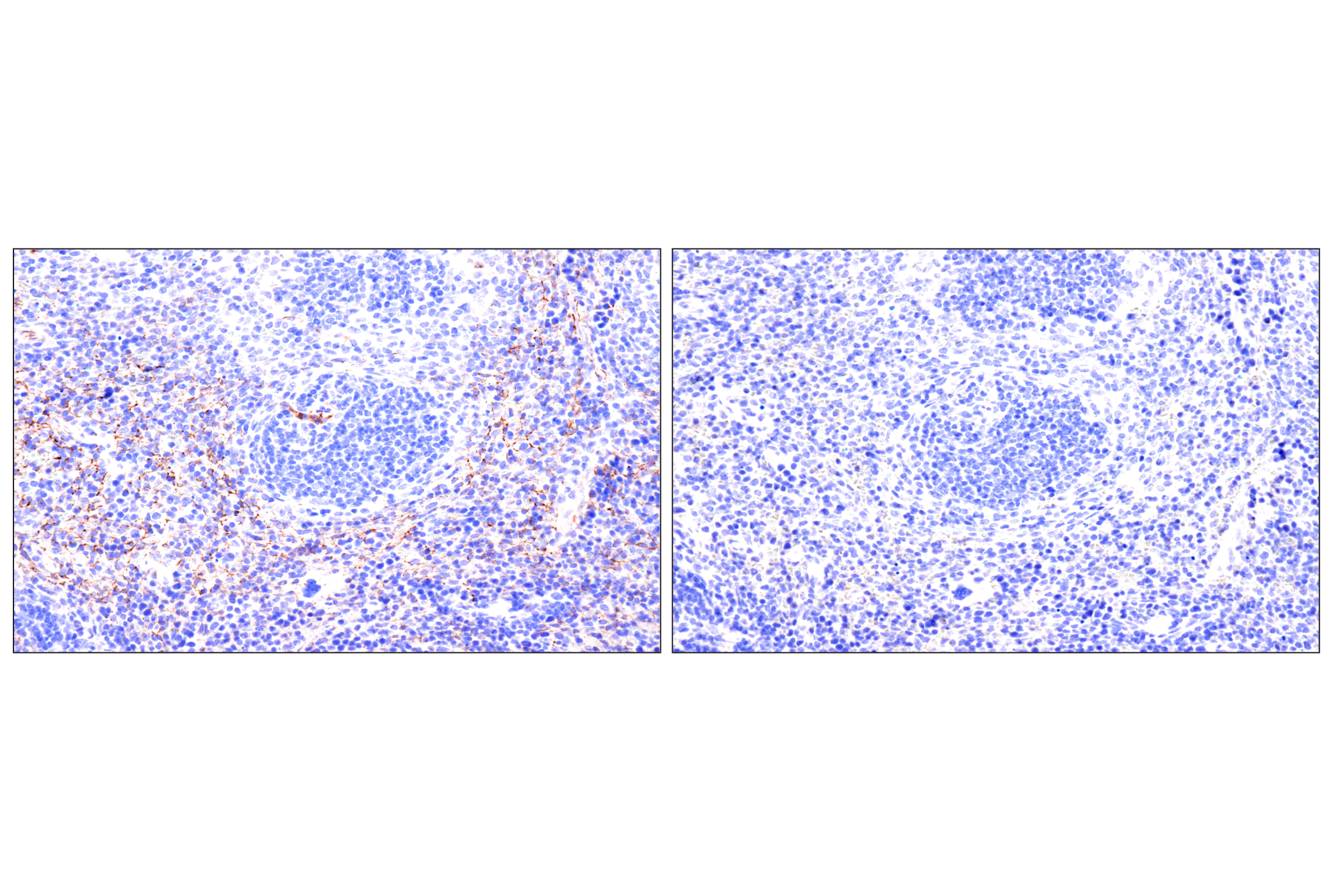 Immunohistochemistry Image 13: Nestin (E5C7I) Rabbit mAb (BSA and Azide Free)