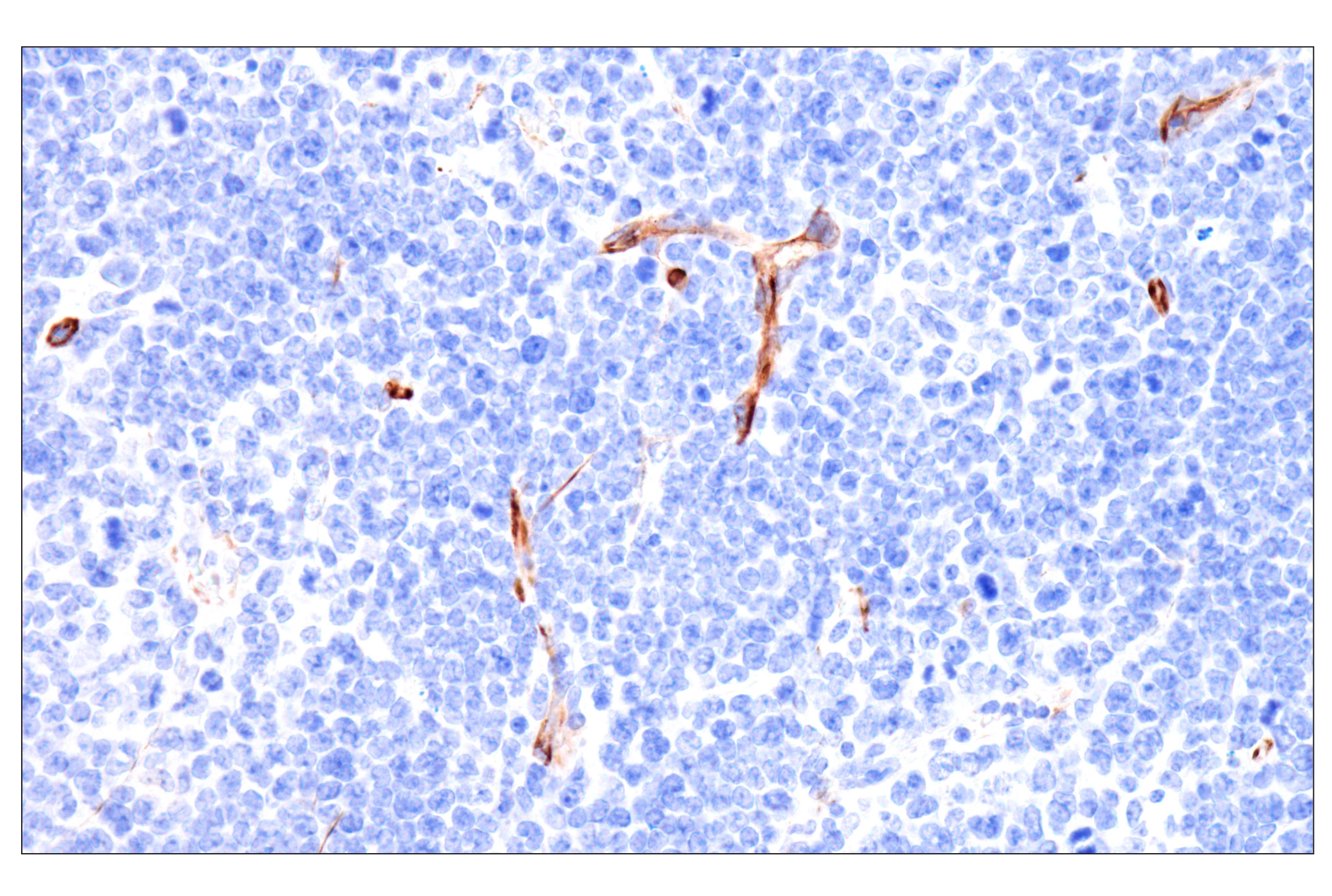 Immunohistochemistry Image 7: Nestin (E5C7I) Rabbit mAb (BSA and Azide Free)
