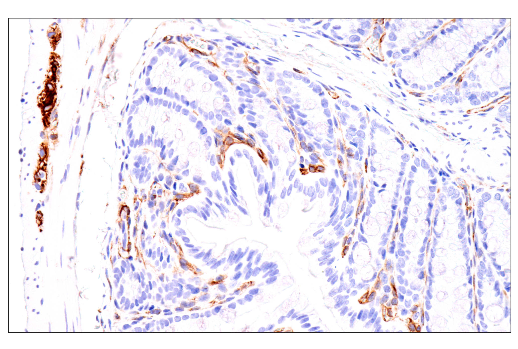 Immunohistochemistry Image 5: Nestin (E5C7I) Rabbit mAb (BSA and Azide Free)