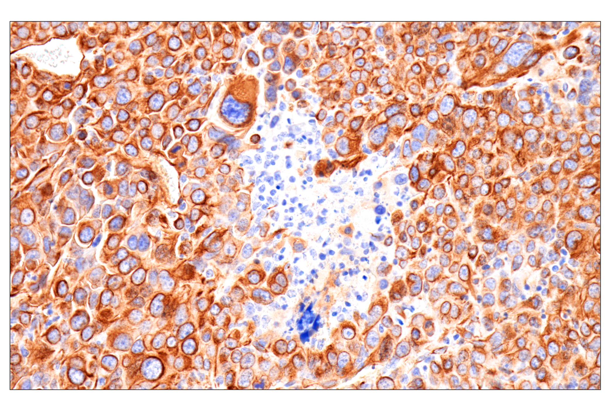 Immunohistochemistry Image 8: Nestin (E5C7I) Rabbit mAb (BSA and Azide Free)