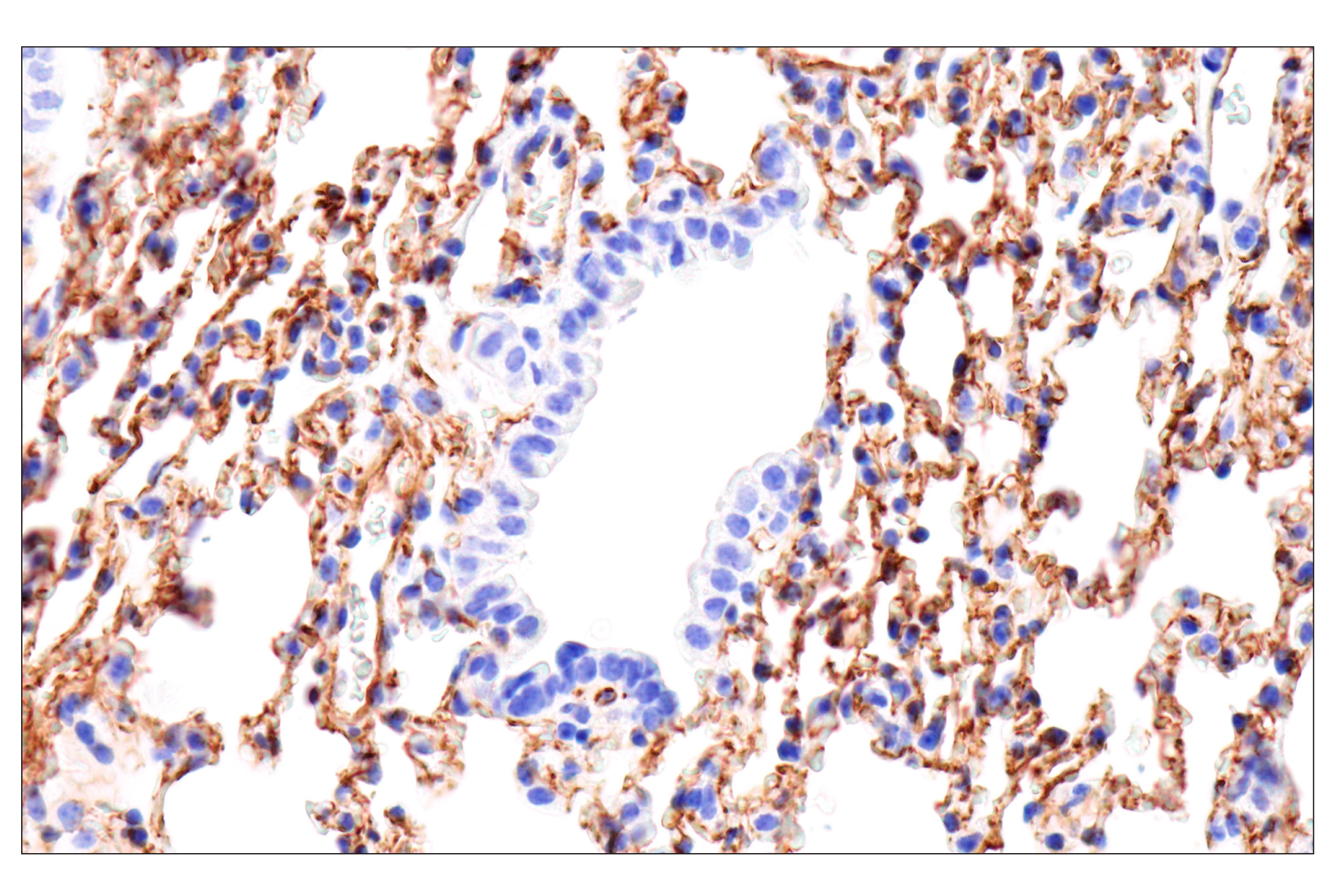 Immunohistochemistry Image 3: Nestin (E5C7I) Rabbit mAb (BSA and Azide Free)