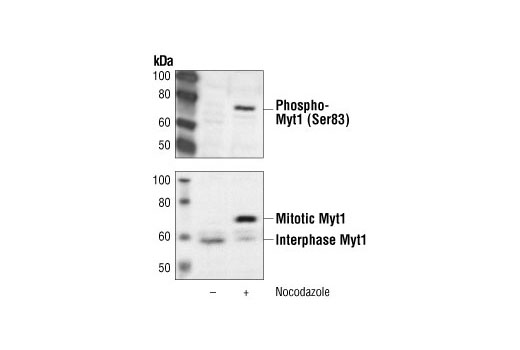 Western Blotting Image 1: Phospho-Myt1 (Ser83) Antibody