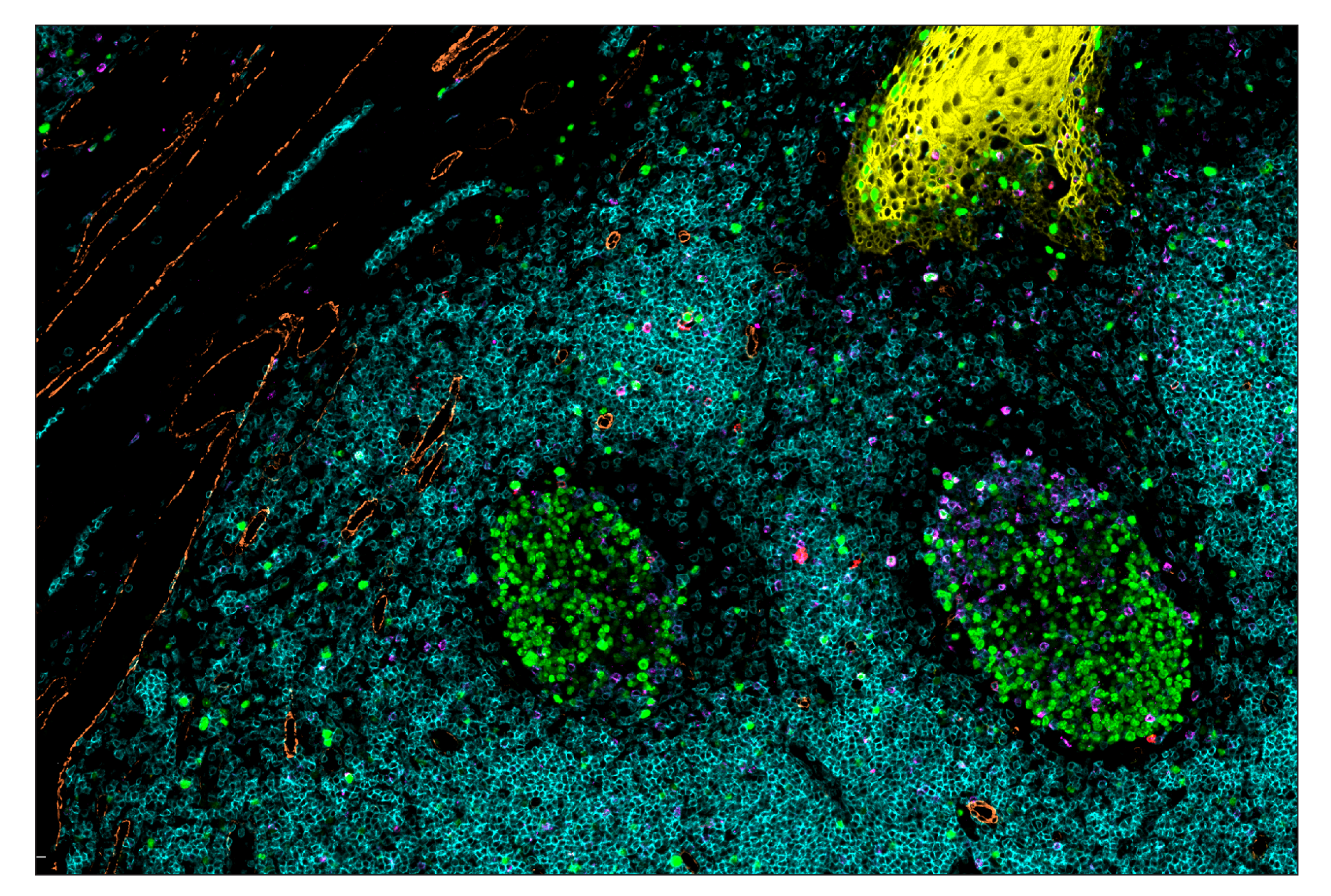 Immunohistochemistry Image 5: OX40 (E9U7O) & CO-0086-594 SignalStar™ Oligo-Antibody Pair