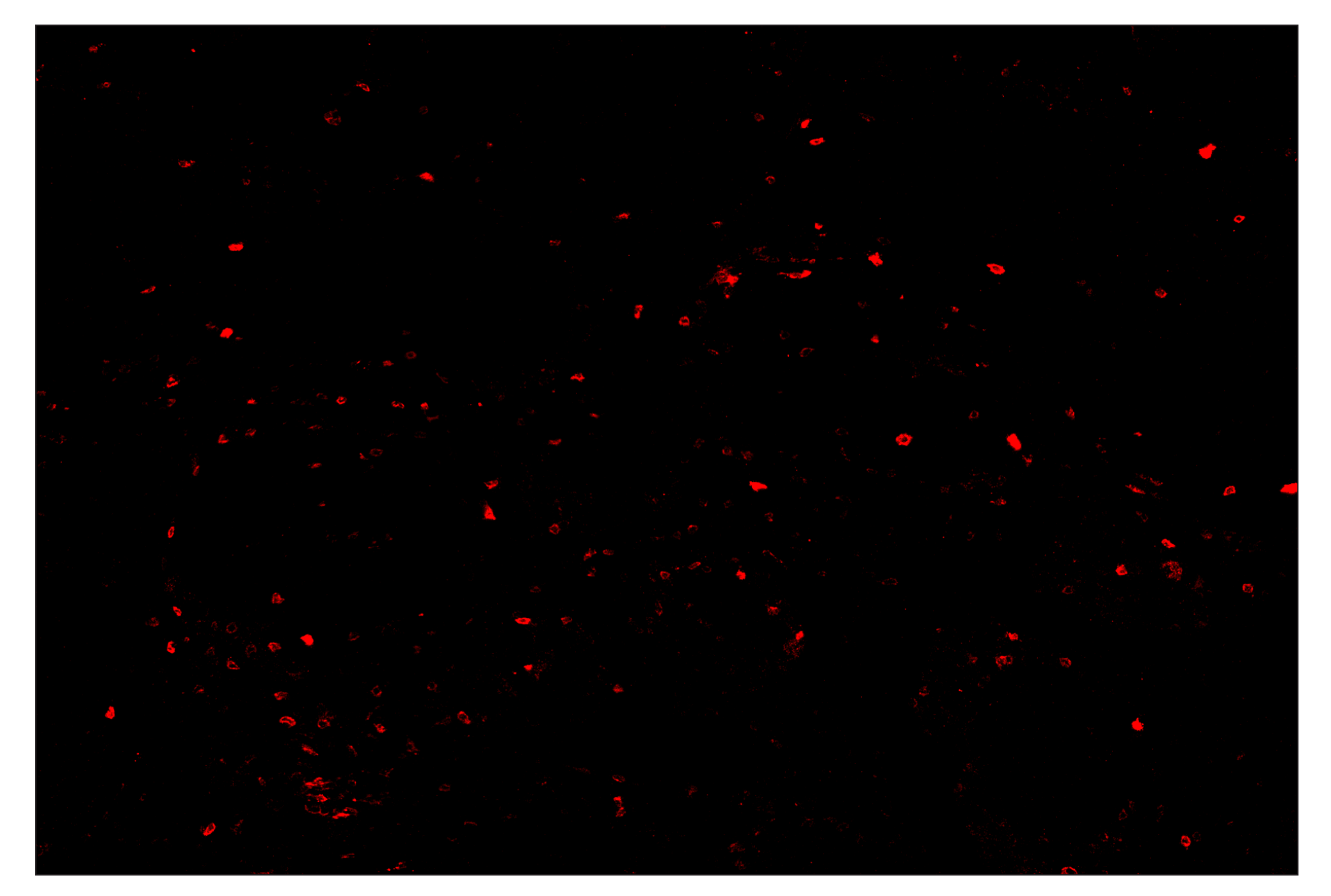 Immunohistochemistry Image 3: OX40 (E9U7O) & CO-0086-488 SignalStar™ Oligo-Antibody Pair
