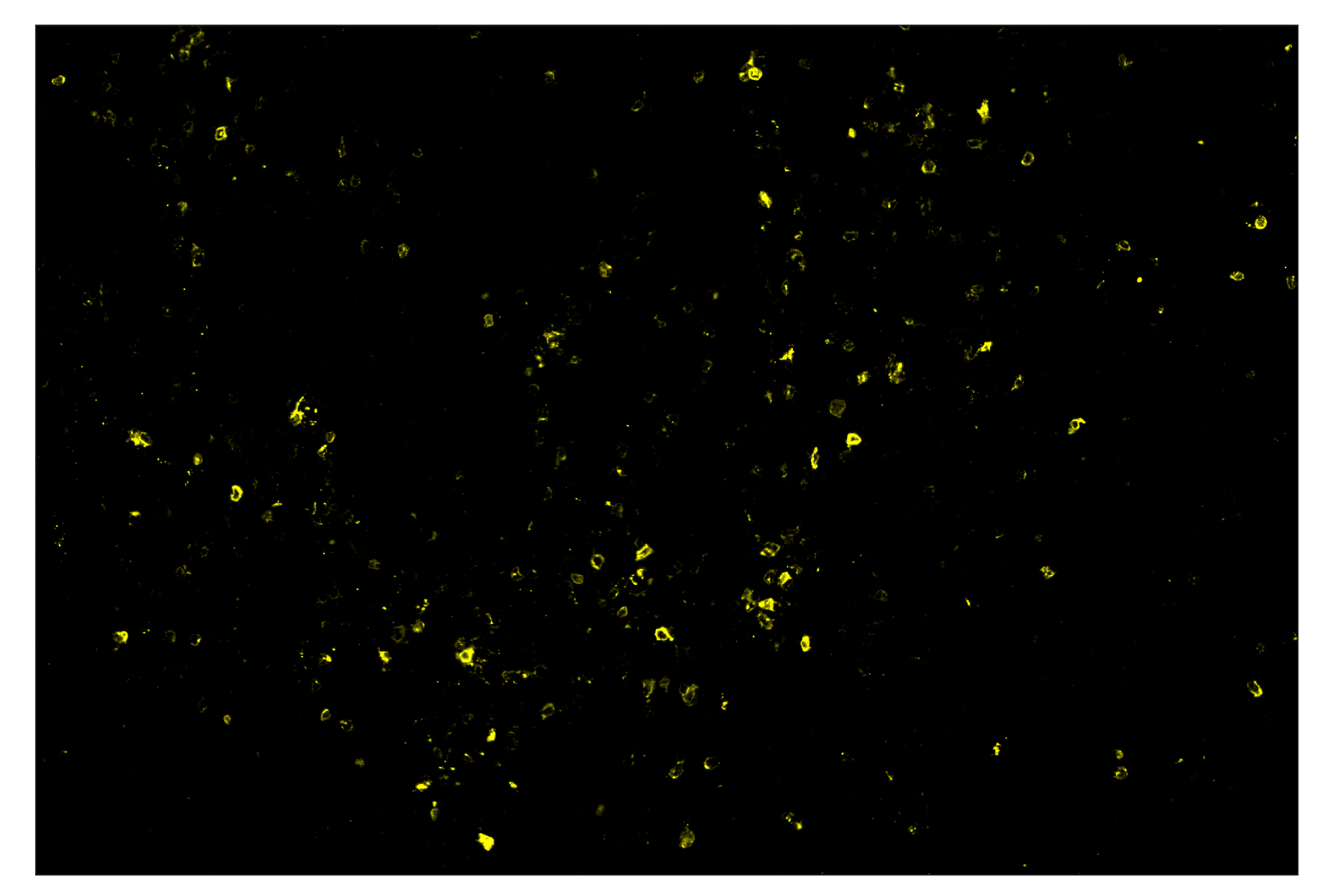 Immunohistochemistry Image 2: OX40 (E9U7O) & CO-0086-594 SignalStar™ Oligo-Antibody Pair