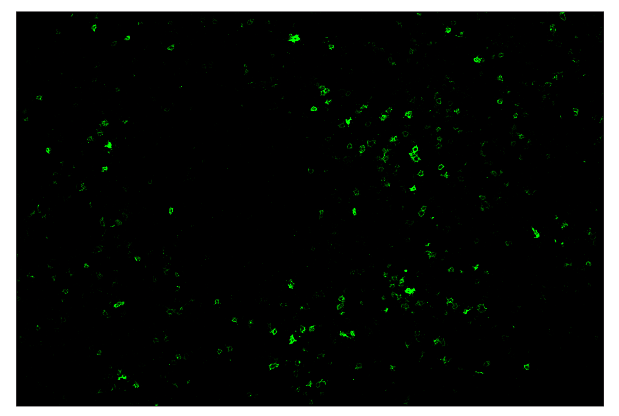 Immunohistochemistry Image 1: OX40 (E9U7O) & CO-0086-488 SignalStar™ Oligo-Antibody Pair
