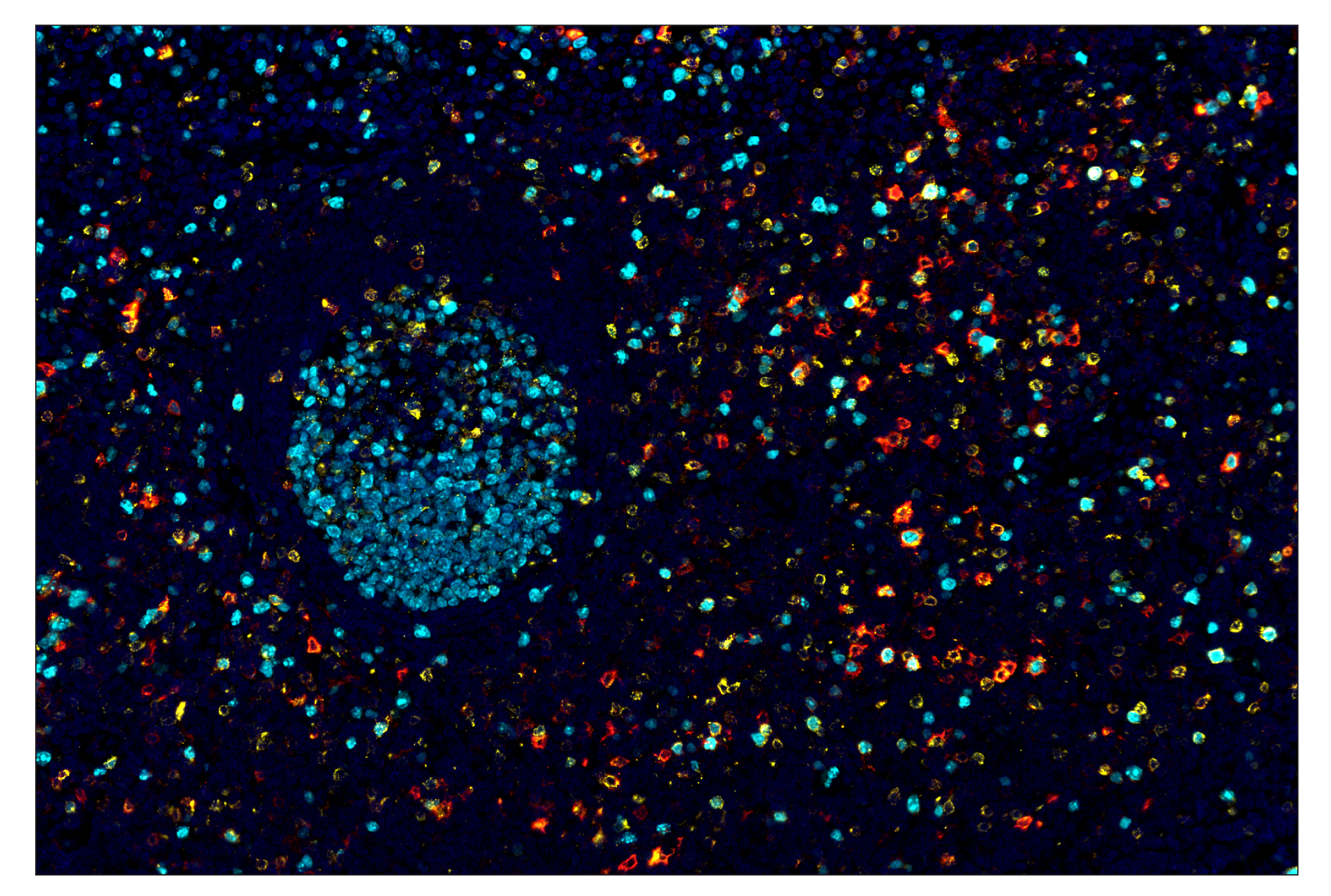 Immunohistochemistry Image 6: OX40 (E9U7O) & CO-0086-488 SignalStar™ Oligo-Antibody Pair
