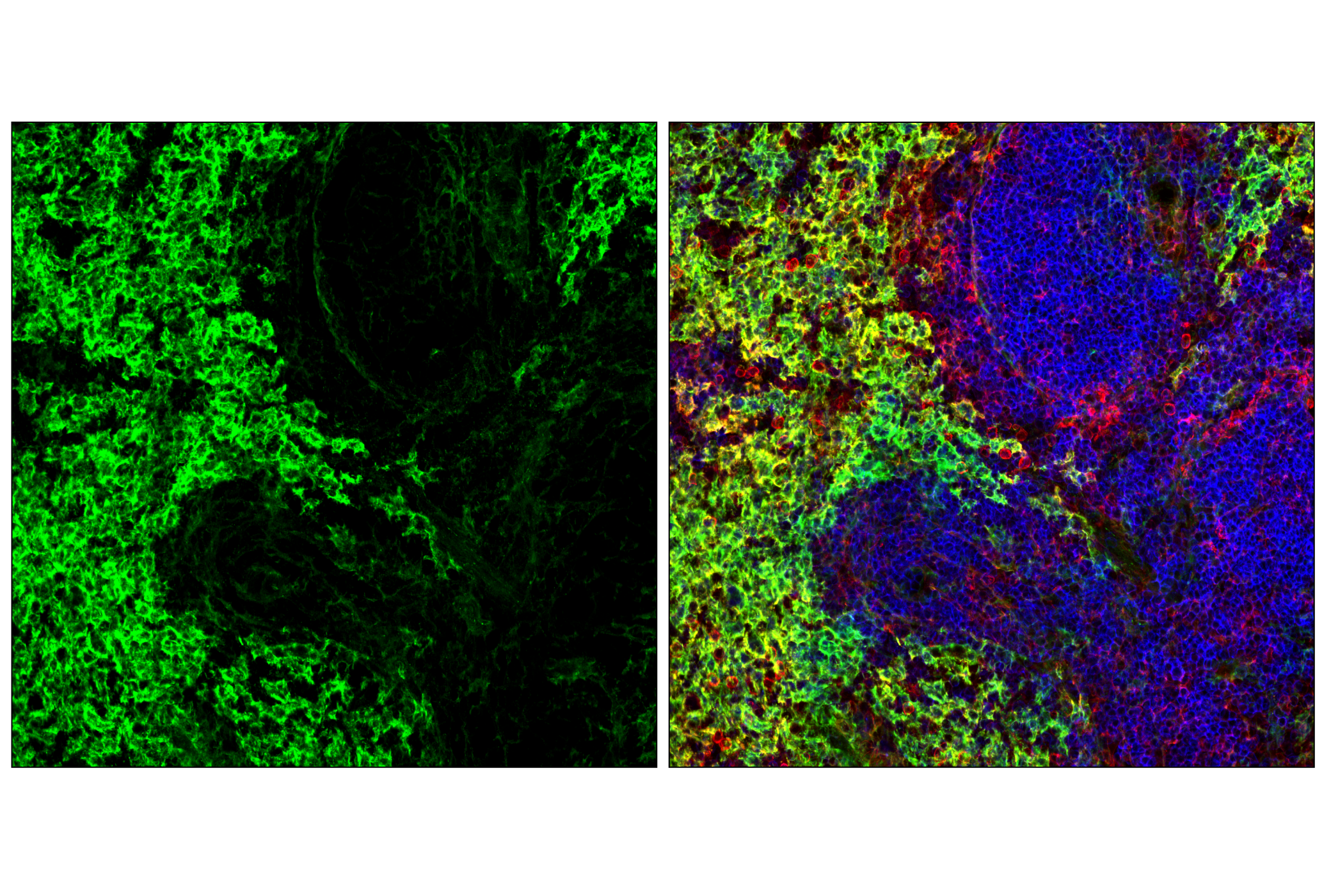 Immunofluorescence Image 2: Axl (F3K7B) Rabbit mAb