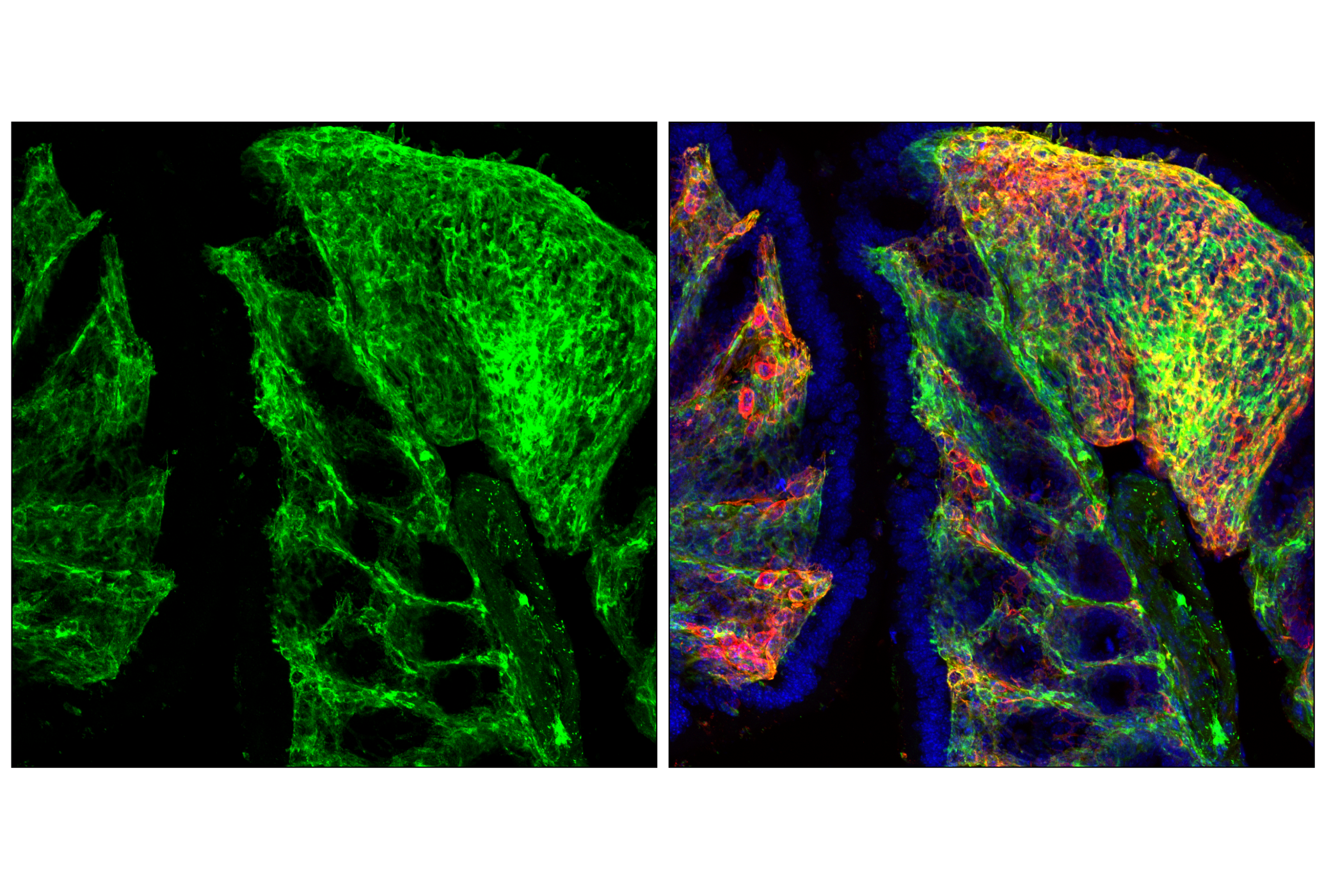 Immunofluorescence Image 3: Axl (F3K7B) Rabbit mAb