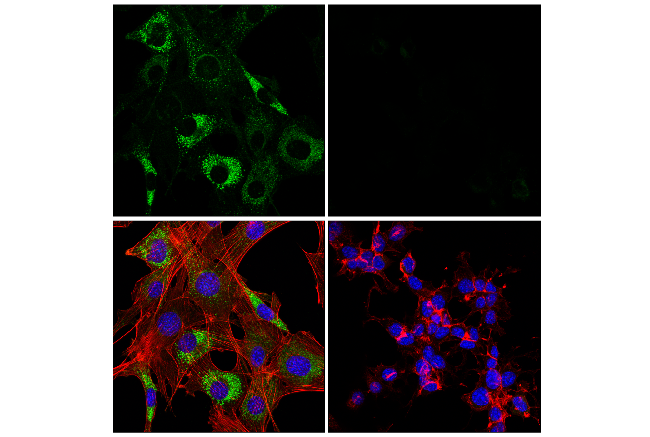Immunofluorescence Image 4: Axl (F3K7B) Rabbit mAb