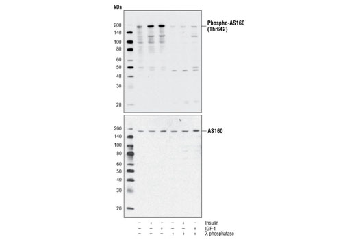 Western Blotting Image 1: Phospho-AS160 (Thr642) Antibody