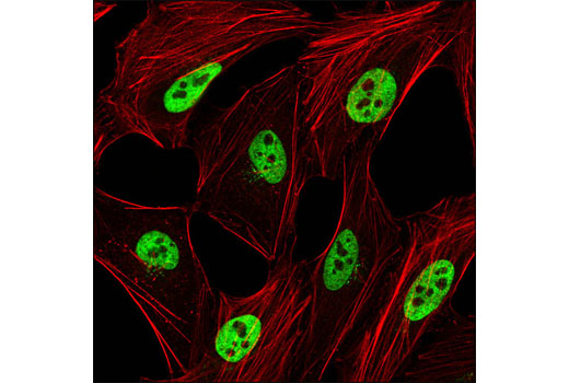 Immunofluorescence Image 1: hnRNP A1 (K350) Antibody
