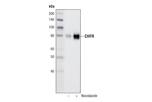 Western Blotting Image 2: CHFR Antibody