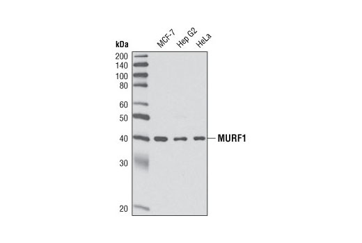 Western Blotting Image 1: MURF1 Antibody