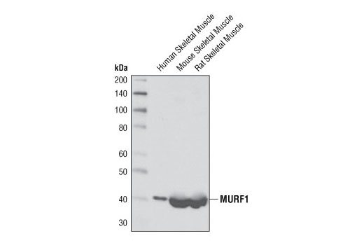Western Blotting Image 2: MURF1 Antibody