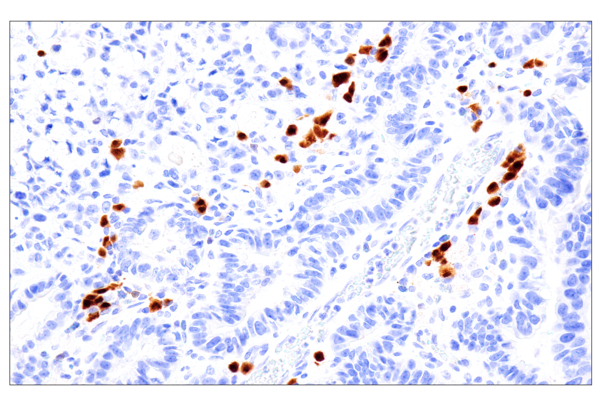 Immunohistochemistry Image 2: BOB-1/OBF-1 (E5K1D) Rabbit mAb