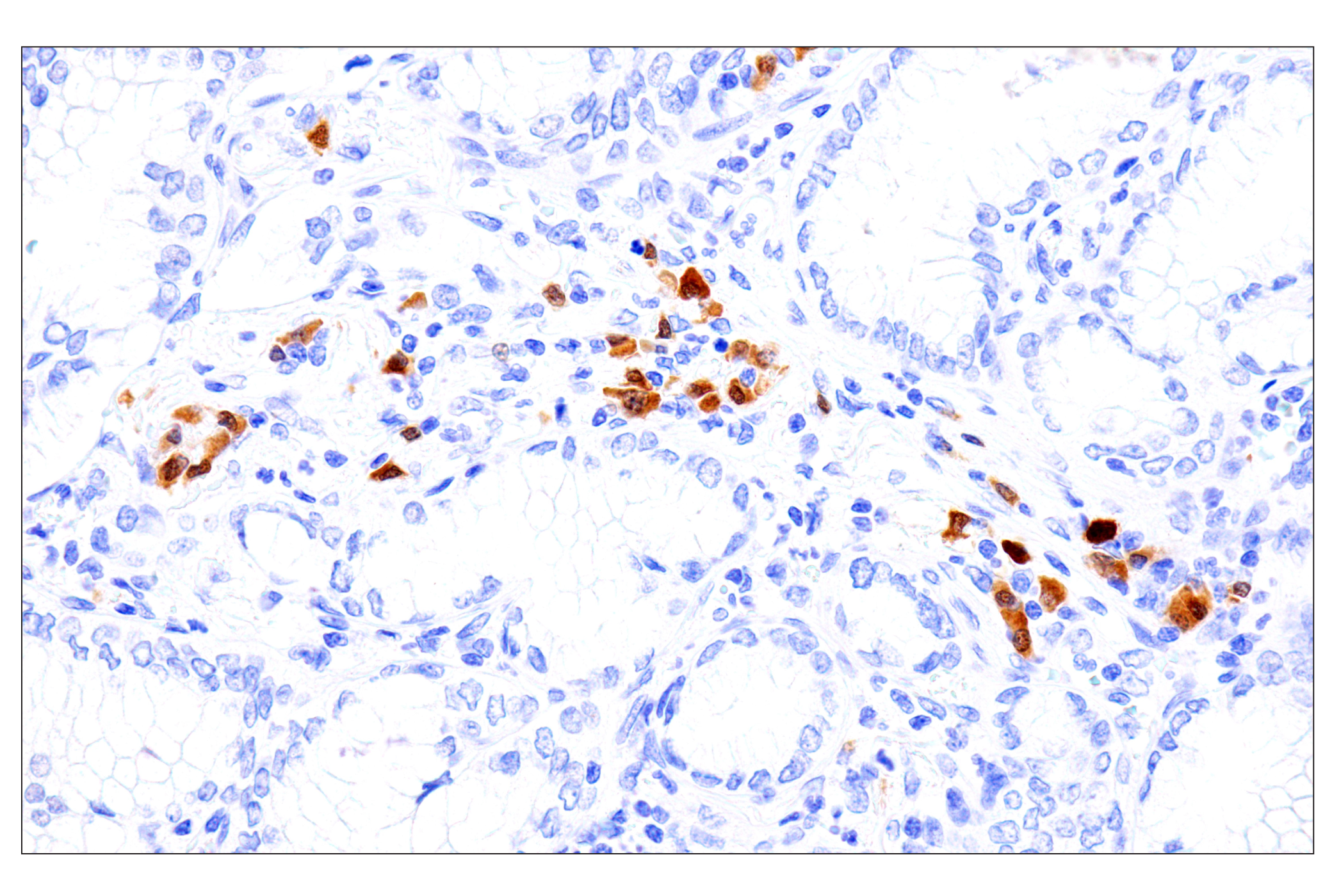 Immunohistochemistry Image 3: BOB-1/OBF-1 (E5K1D) Rabbit mAb
