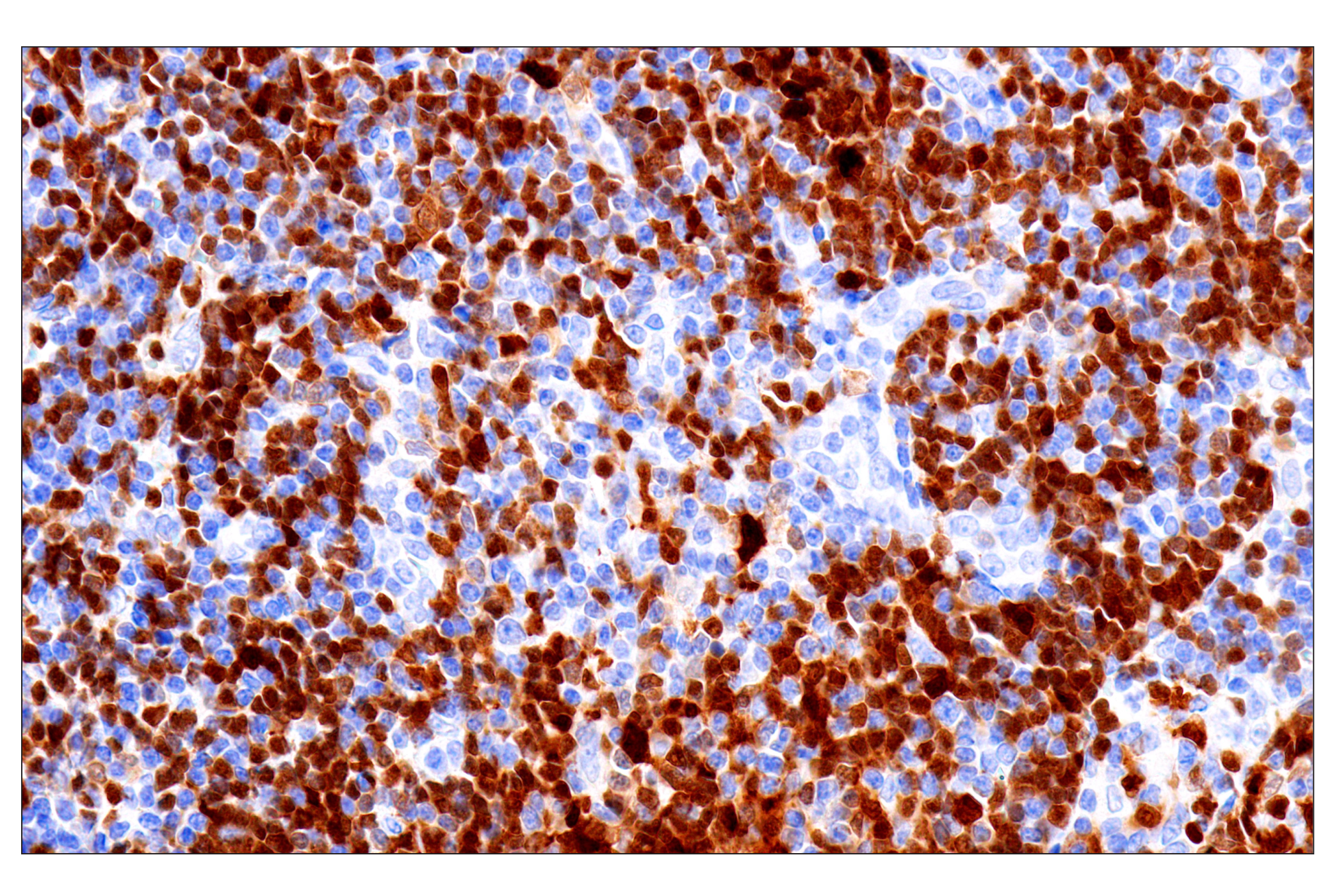 Immunohistochemistry Image 1: BOB-1/OBF-1 (E5K1D) Rabbit mAb