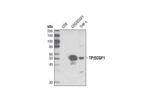 Western Blotting Image 1: Thymidine Phosphorylase/ECGF1 (D69B12) Rabbit mAb