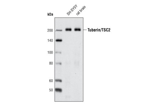Western Blotting Image 1: Tuberin/TSC2 (D93F12) XP® Rabbit mAb