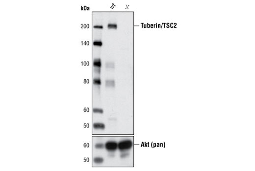 Western Blotting Image 2: Tuberin/TSC2 (D93F12) XP® Rabbit mAb